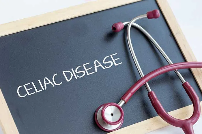 Celiac là bệnh gì? Dấu hiệu, triệu chứng và nguyên nhân