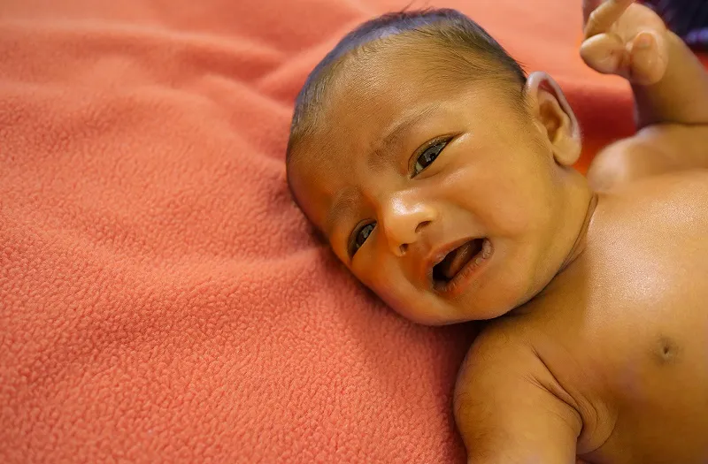 Trẻ sơ sinh bị vàng da: Dấu hiệu và triệu chứng là gì?