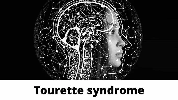 Hội chứng Tourette là gì? Nguyên nhân, triệu chứng và cách chẩn đoán